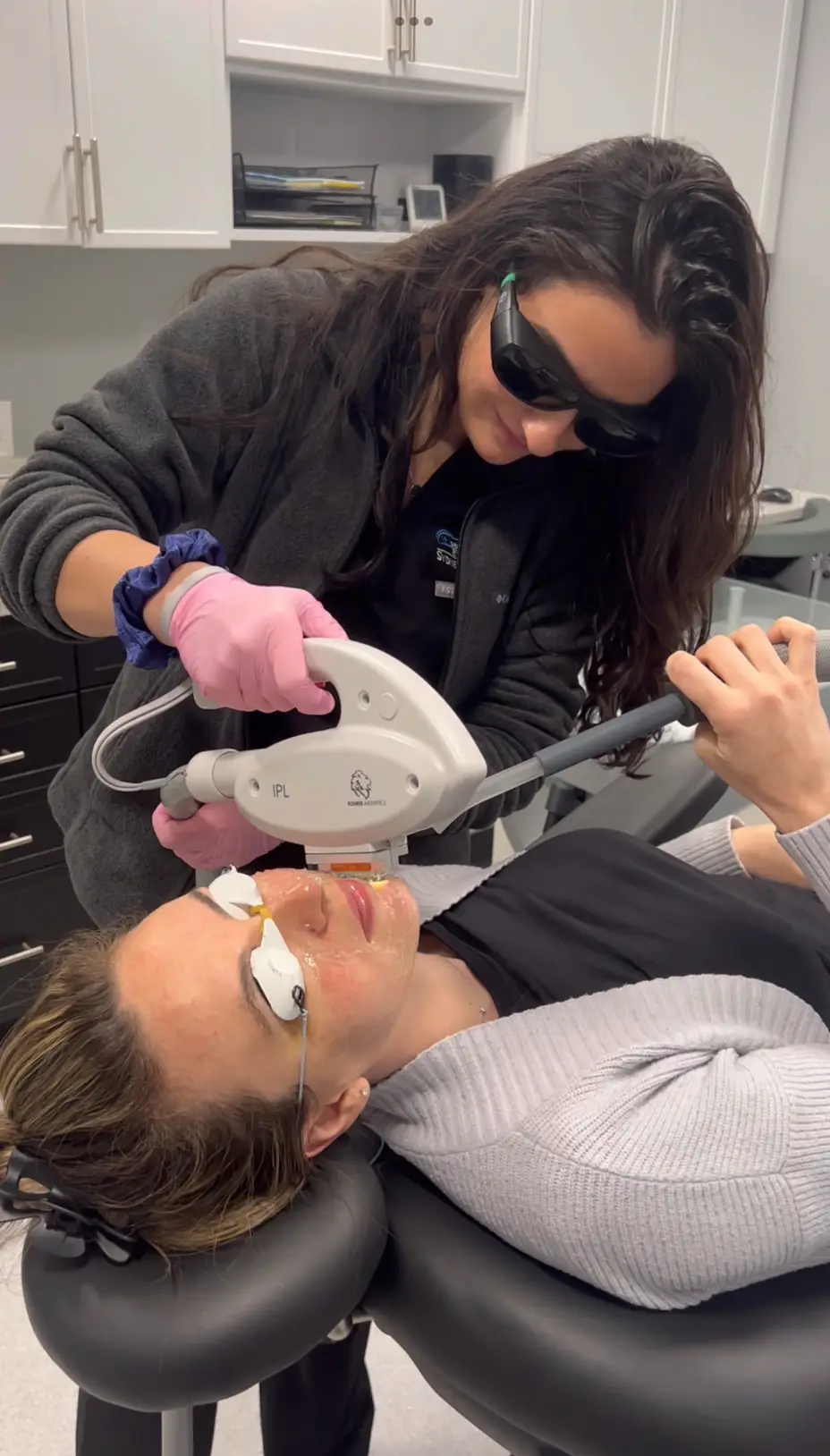 IPL treatment performed at Bergen Eyelids
