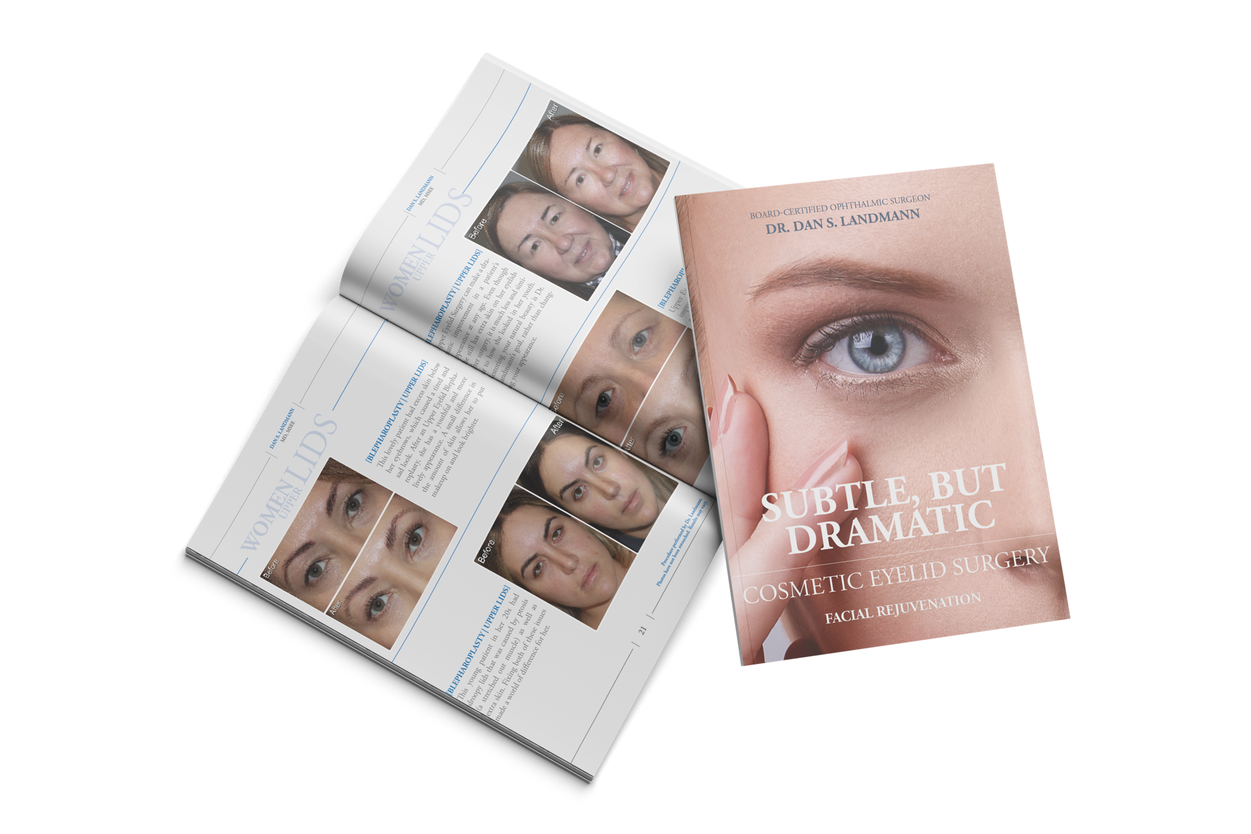 Bergen Eyelids cosmetic eyelid surgery and facial rejuvenation magazine