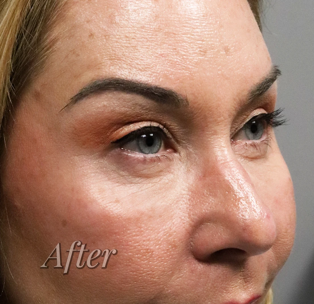 After treatment