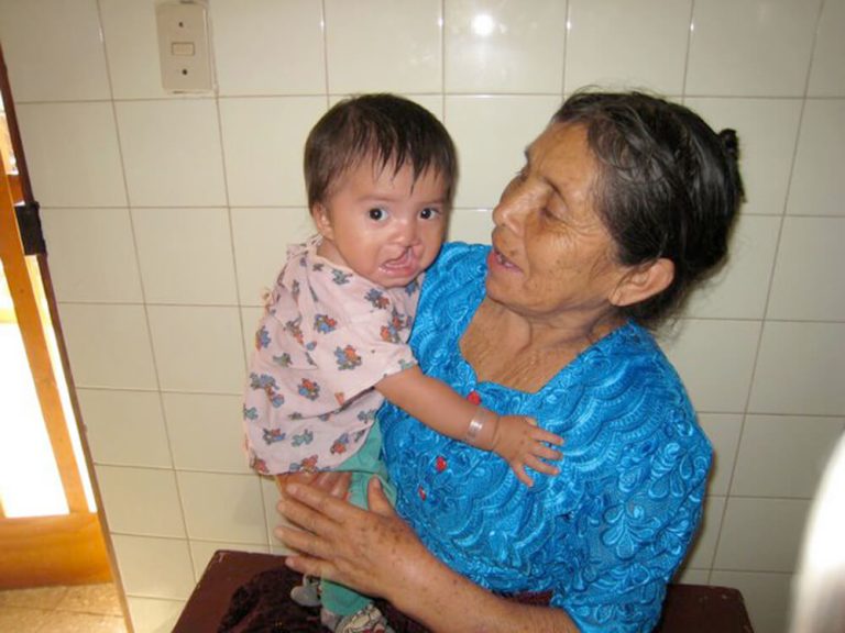 A photo of a grandmother with her grandchild that has a Cleft lift condition in Guatemala.